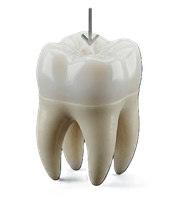 Dental crowns and restorations in Dodge Center MN